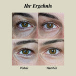 Nordic Cosmetics Augencreme CBD & Hyaluronsäure
